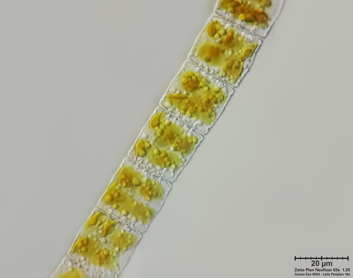 Diatoma (mesodon?)
